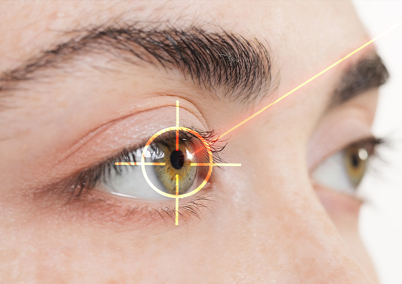 Lasik